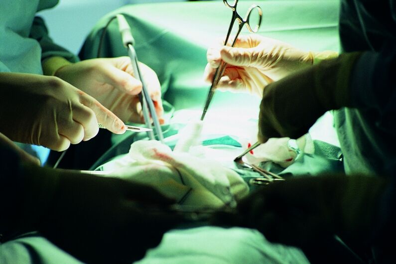 chirurginis varpos storio padidėjimas