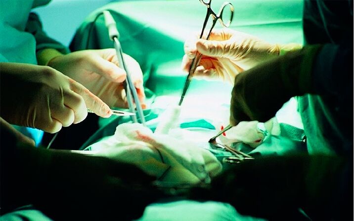 Mikro chirurginė raumenų transplantacija